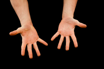 Two open hands with spread fingers on a black background.