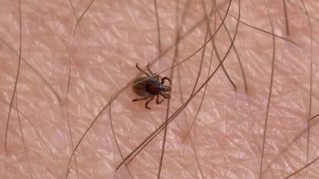 Parasitic Tick Crawling on Human Skin Searching for Feeding Spot