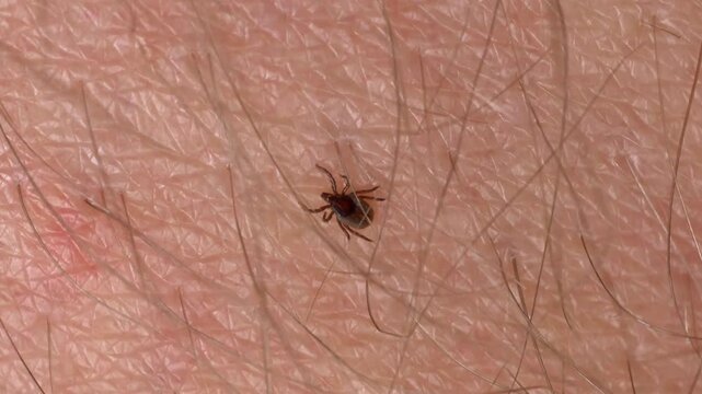 Parasitic Tick Crawling on Human Skin Searching for Feeding Spot
