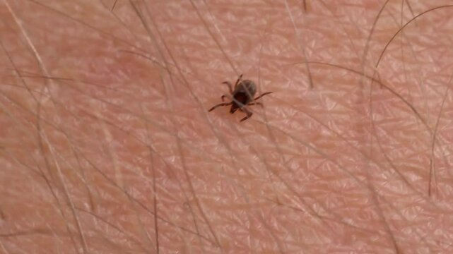Parasitic Tick Crawling on Human Skin Searching for Feeding Spot
