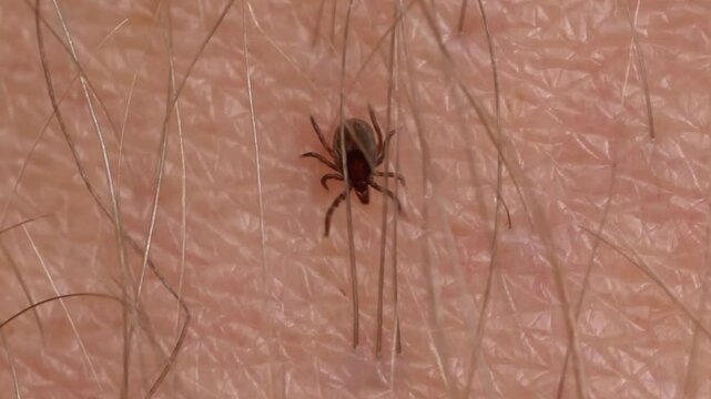 Parasitic Tick Crawling on Human Skin Searching for Feeding Spot