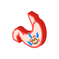 gastric ulcer gastroenterologist isometric icon vector illustration