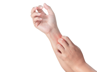 Close up woman's arm scratch the itch by hand at home, itching due to rash, fungus, allergy, dermatological disease, dry skin. Healthcare and medical concept. isolated on transparent background, PNG