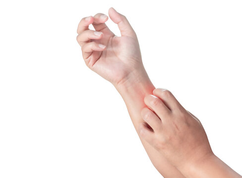 Close up woman's arm scratch the itch by hand at home, itching due to rash, fungus, allergy, dermatological disease, dry skin. Healthcare and medical concept. isolated on transparent background, PNG