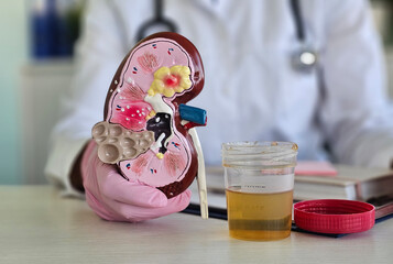 Medical professional demonstrating kidney anatomy with model and urine sample in office