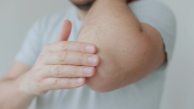 Applying cream to relieve dryness on the elbow for better skin health