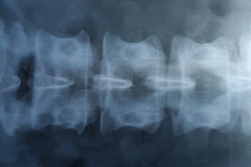 Naklejka premium X-ray image of spinal column as background, closeup