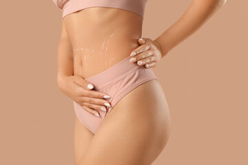 Woman in underwear with marks on her belly against beige background, closeup. Plastic surgery concept