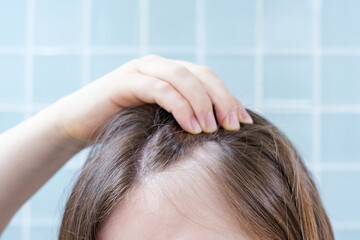 Naklejka premium Woman touching her hair close-up against background of blue tiles, hair loss concept.
