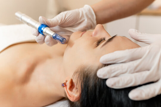Cosmetologist doing microneedling, patient care using dermapen in a beauty salon