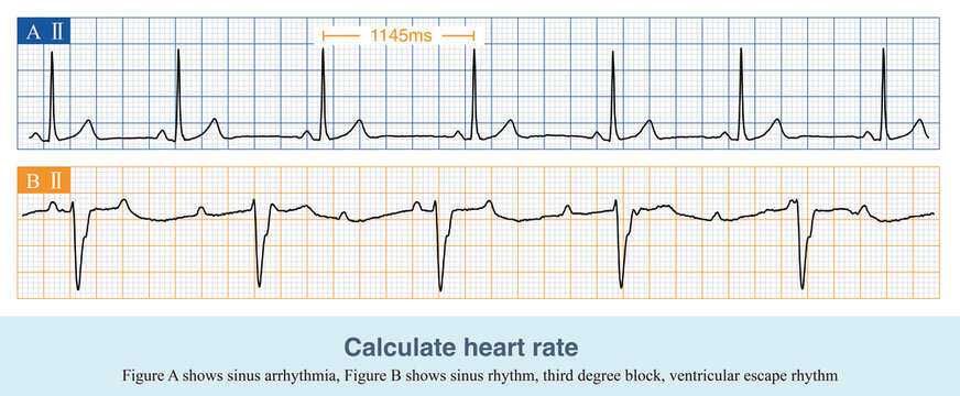 Normal Conduction Rates รูปภาพConduction – เลือกดูภาพถ่ายสต็อก เวกเตอร์ และวิดีโอ39,581 | Adobe ...