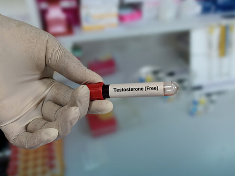 Doctor hold blood sample for Testosterone (Free) test with laboratory background.