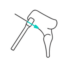  Innovative Femoral Introducer Device