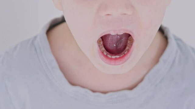 Macro shot of a child open mouth showing visible plaque on the lower teeth. Realistic dental condition, pediatric hygiene awareness, light background