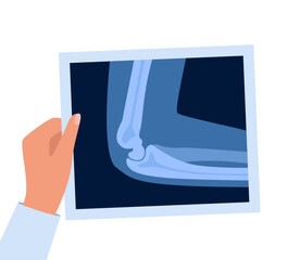 XRayBonesDoctorHand2-07.eps