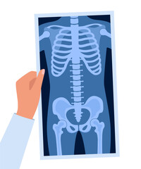 XRayBonesDoctorHand2-11.eps