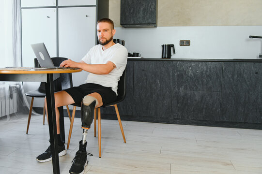 Man amputee with prosthetic leg disability on above knee transfemoral leg prosthesis artificial device at home. People with amputation disabilities everyday life - Powered by Adobe