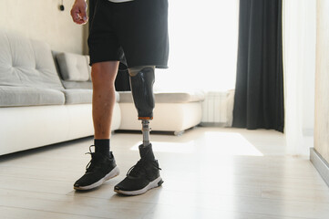 Man amputee with prosthetic leg disability on above knee transfemoral leg prosthesis artificial...