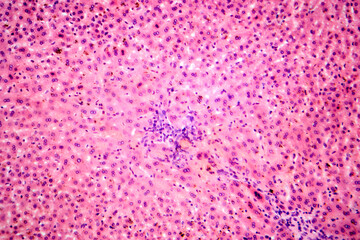 Coccidia in liver, photomicrograph showing intracellular parasitic protozoa causing hepatic...