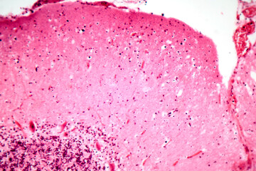 Human motor cortex, photomicrograph showing pyramidal neurons in cortical layers responsible for voluntary movement control and motor coordination.