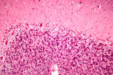 Human motor cortex, photomicrograph showing pyramidal neurons in cortical layers responsible for voluntary movement control and motor coordination.