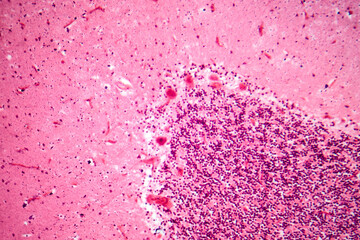 Human motor cortex, photomicrograph showing pyramidal neurons in cortical layers responsible for voluntary movement control and motor coordination.