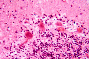 Fototapeta premium Human motor cortex, photomicrograph showing pyramidal neurons in cortical layers responsible for voluntary movement control and motor coordination.