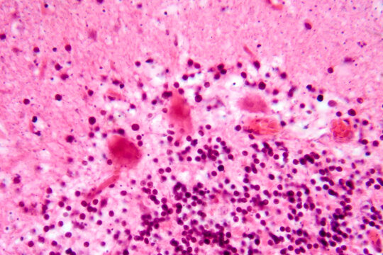 Human motor cortex, photomicrograph showing pyramidal neurons in cortical layers responsible for voluntary movement control and motor coordination.