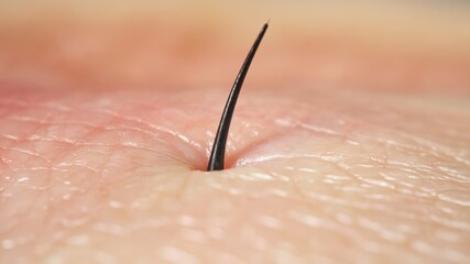 Ingrown hair on skin