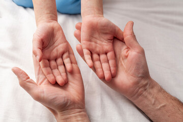 Child shows palms to doctor. Rash or allergic dermatitis. Concept rubella and viral diseases in children