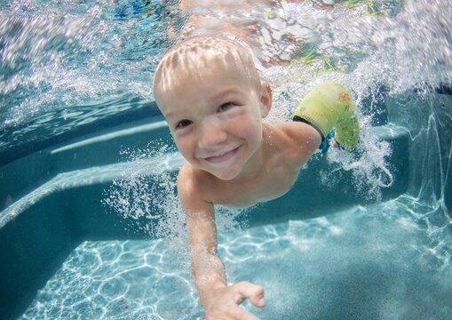 Smiling boy wearing a plaster cast on his broken arm swimming underwater in a swimming pool