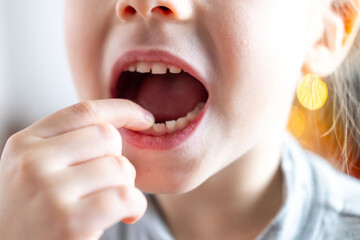 closeup hand child, girl 6 years old points new tooth fang in mouth with finger, children's health,...