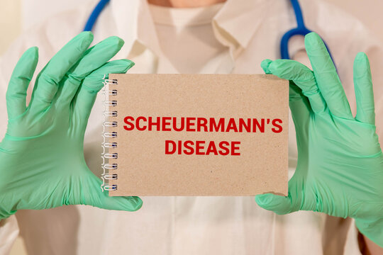 Scheuermann's Disease: Are you at risk