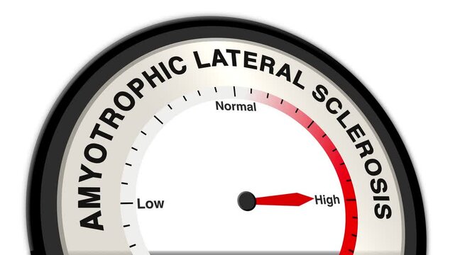 Amyotrophic Lateral Sclerosis (ALS) text or word displayed with a barometer or tachometer-style gauge showing levels from low to normal to high, symbolizing the progression of ALS symptoms and disease
