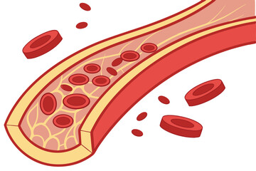 28 Medical illustration, cross-section of blood vessels, red blood cells, cholesterol buildup, arterial plaque, circulatory system, atherosclerosis progression, scientific diagram, detailed anatomy, c
