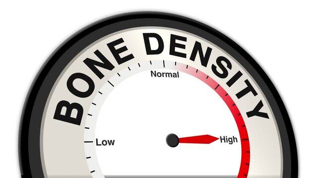 Bone Density text or word displayed with a barometer or tachometer-style gauge showing levels from low to normal to high, symbolizing bone health and osteoporosis risk
