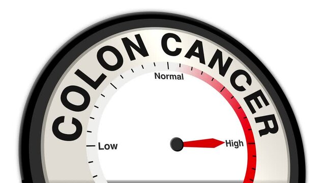 Colon cancer text or word displayed with a barometer or tachometer-style gauge showing levels from low to normal to high, symbolizing the stages of colon cancer progression and severity