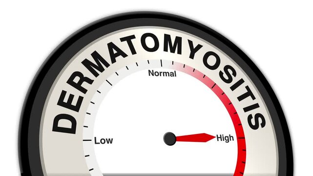 Dermatomyositis text or word shown with a barometer or tachometer-style gauge, representing varying levels of skin and muscle inflammation severity