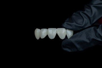 Dental Technician Works High aesthetics
