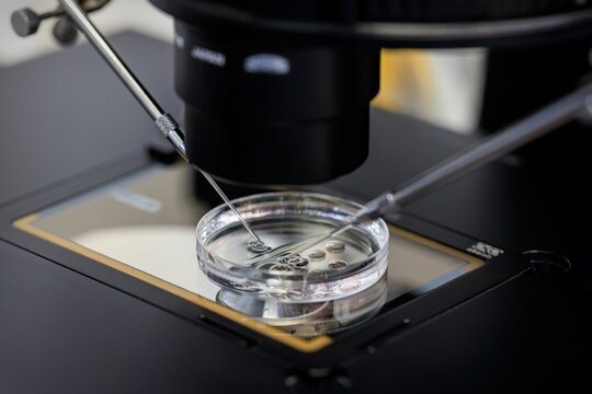 Microsurgical manipulation of cells in Petri dish during IVF procedure under microscope