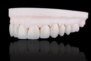 Quality dental zirconium crowns of upper jaw stylized as young teeth on 3D printed model.