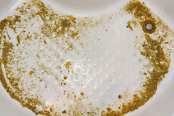 scale after cleaning the heating element in the shower. Limescale on the heating element of the water heater, scale is formed due to hot and hard water, rust that gets into the boiler along with it.