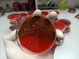 Microbiologist hold Bacteria culture growth on a petri dish in the microbiology lab. gram-positive...