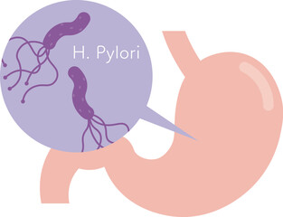 ピロリ菌のイラスト Helicobacter pylori illustration