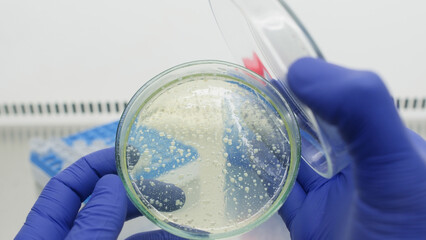 Opening a petri dish containing bacterial colonies in a sterile laboratory environment.