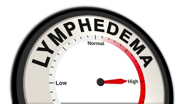 Lymphedema text or word shown with a barometer or tachometer-style gauge, representing varying levels of swelling severity due to lymphatic fluid buildup in tissues