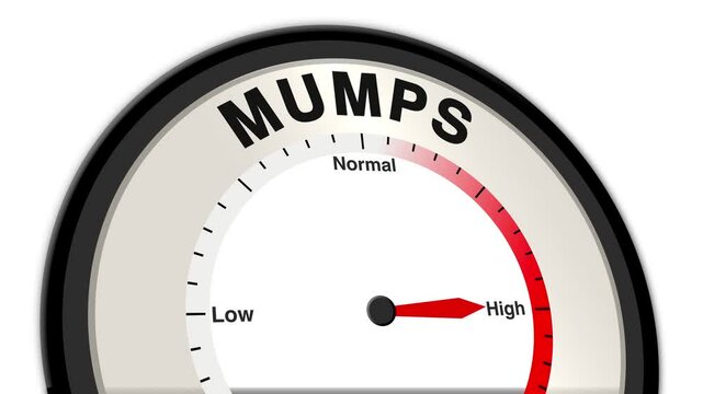 Mumps text or word shown with a barometer or tachometer-style gauge, representing varying levels of symptom severity such as swelling, pain, and fever