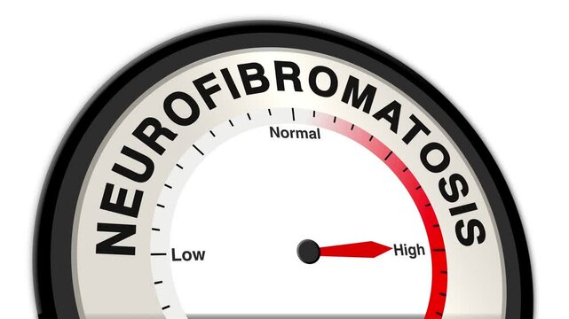 Neurofibromatosis text or word shown with a barometer or tachometer-style gauge, representing varying levels of severity in tumor growth and neurological symptoms