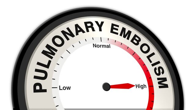 Pulmonary Embolism text or word shown with a barometer or tachometer-style gauge, representing varying levels of risk and severity of blood clot obstruction in the lungs