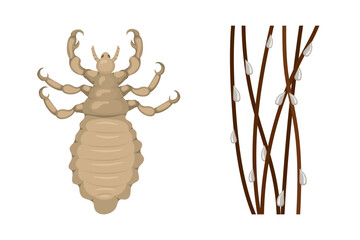 Head louse and nits clinging to hair strands causing pediculosis